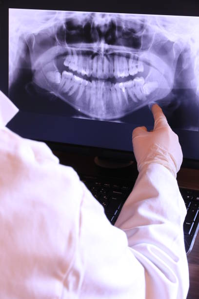 Best Emergency Treatment for Toothache in San Fernando, CA